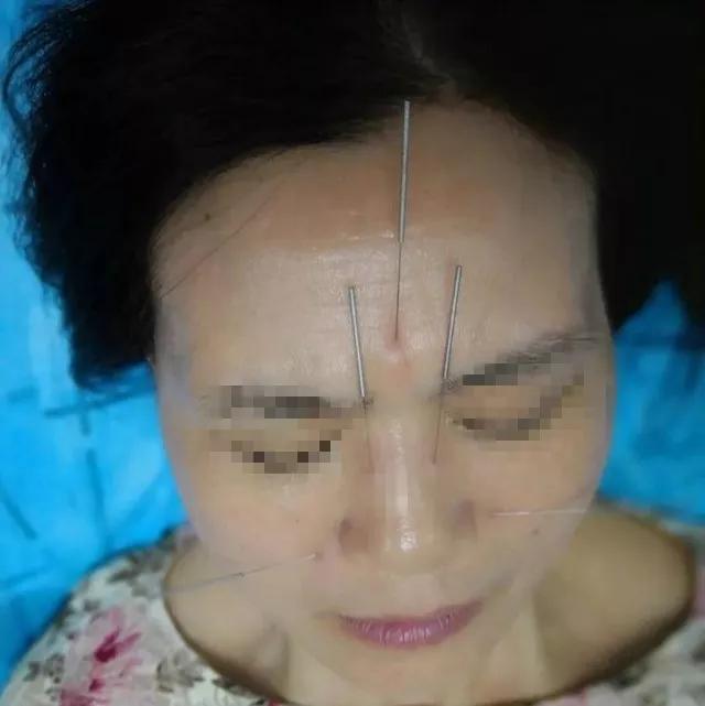 ȡ������ܱM�쾏�⻼�߱ǲ��Y��