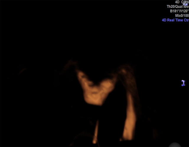 ���(c��)ݔ�ѹ�ͨ�����҂�(c��)ݔ�ѹܶ���